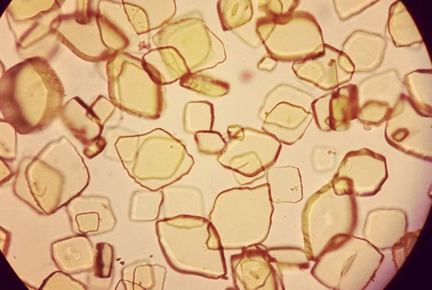 <p>pH <7.5</p>