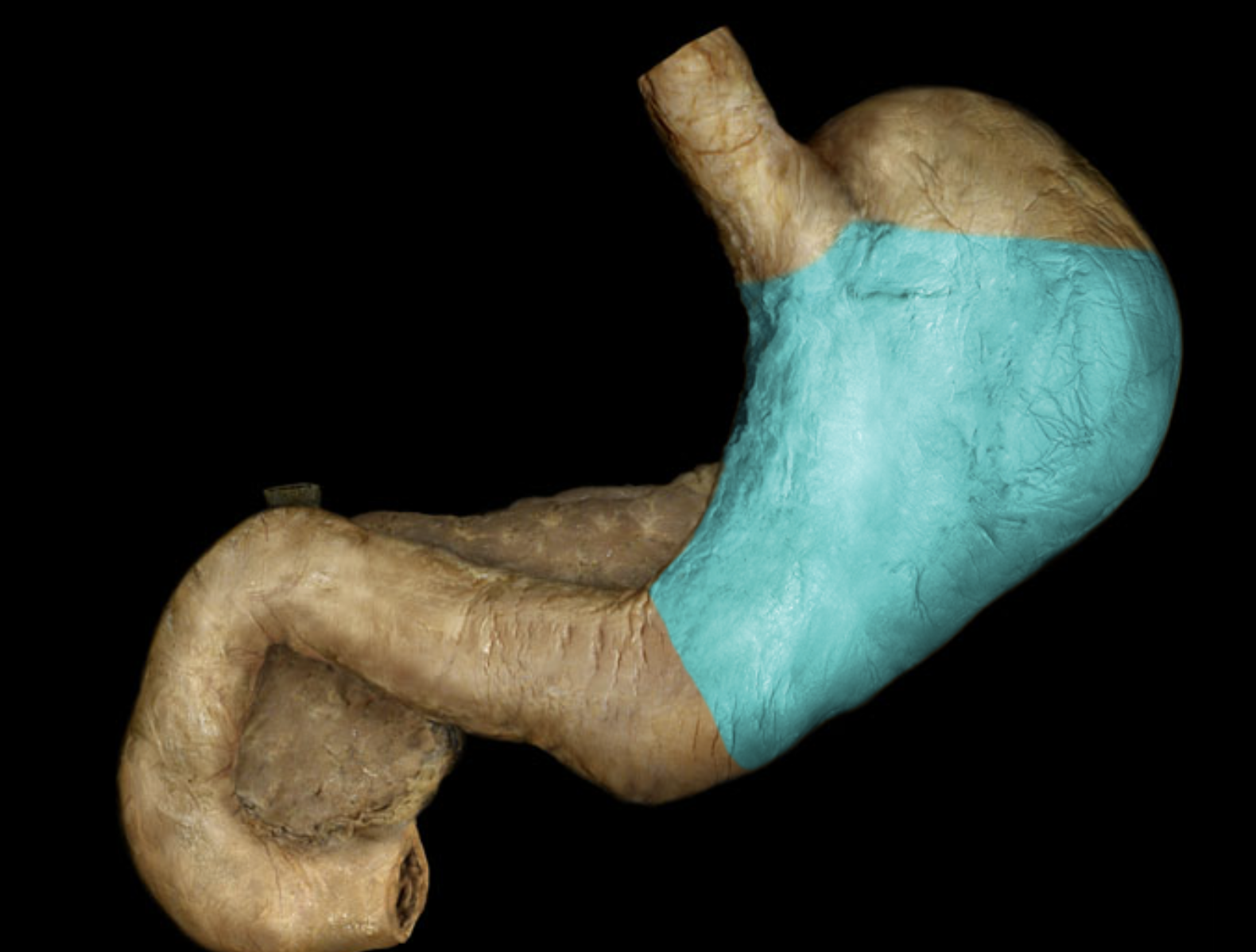 term image