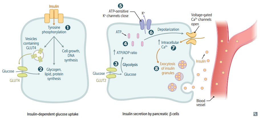 <ul><li><p>Endogenous hyperinsulinemia (eg, insulinoma, sulfonylureas): ↑ insulin + ↑ C-peptide.</p></li><li><p>Exogenous insulin administration: ↑ insulin + ↓ C-peptide (because injected insulin lacks C-peptide).</p></li></ul><p></p>