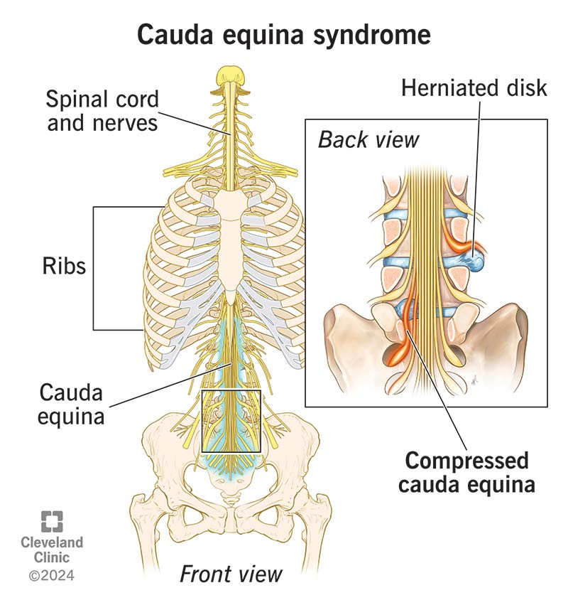 <p>Means horse tail.</p><p>Level of L2. </p><p>The roots of the lumbar and sacral spinal nerves form a bundle within the lowest part of the spinal column</p>