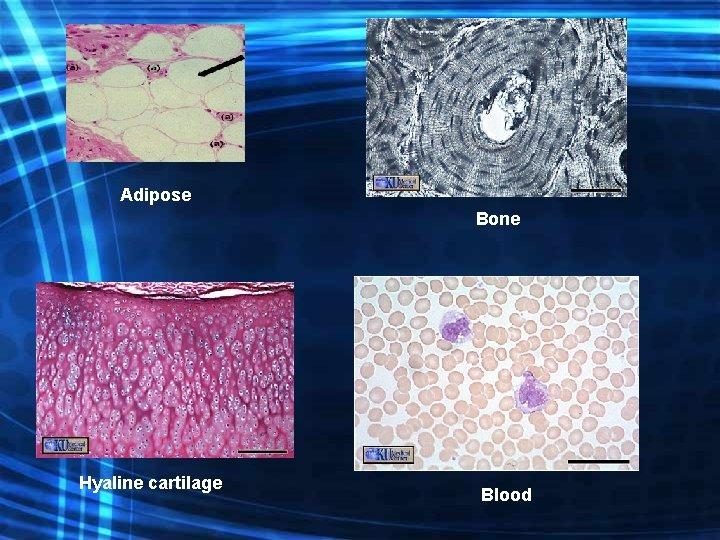 <ol><li><p>Connective tissue proper</p></li><li><p>cartilage</p></li><li><p>bone</p></li><li><p>blood.</p></li></ol><p></p>