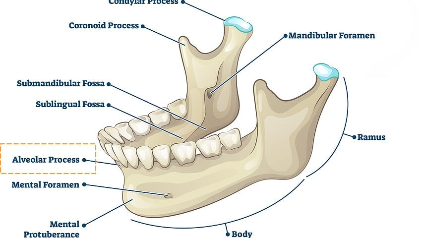 <p>What Bony Feature </p>