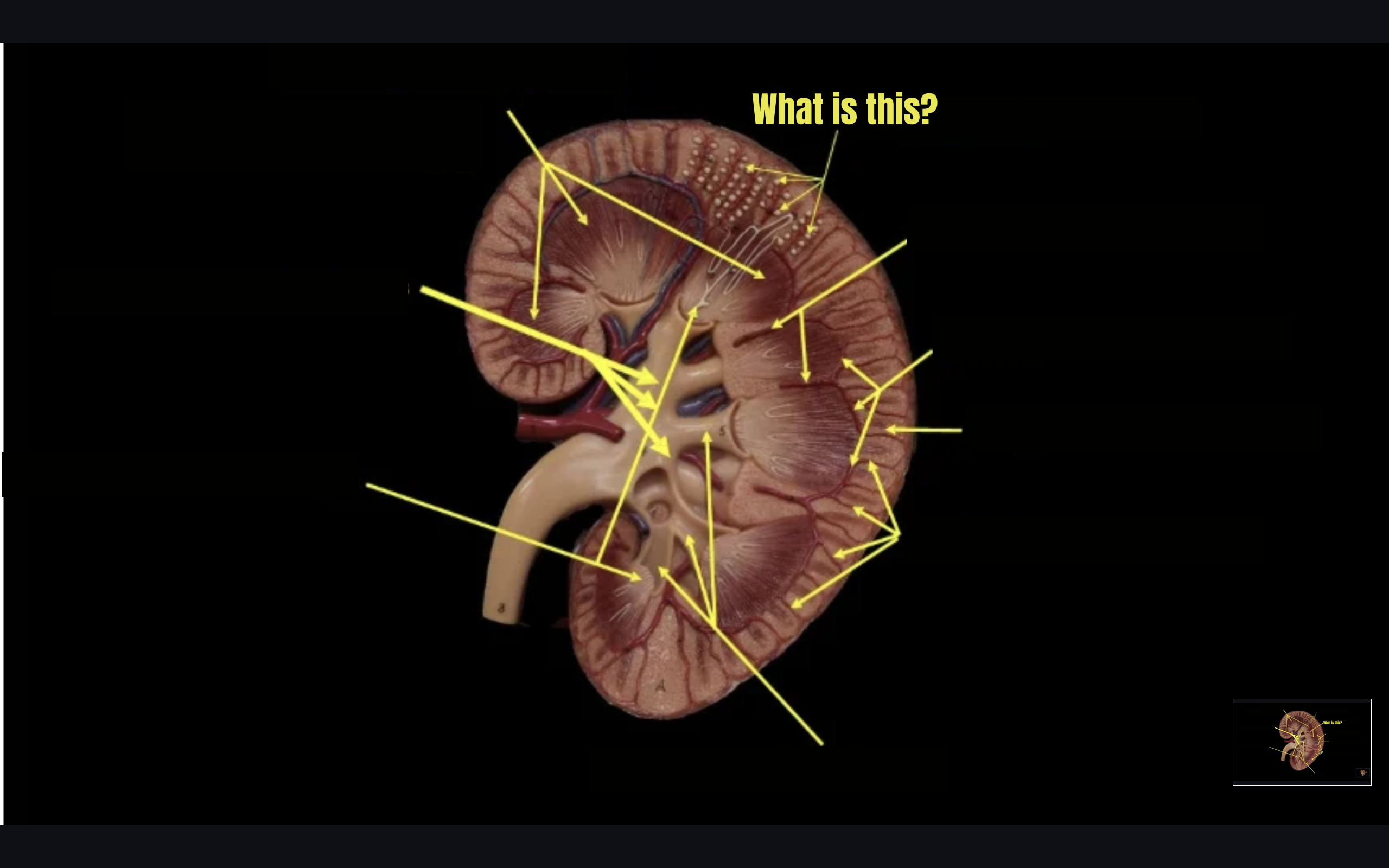 term image
