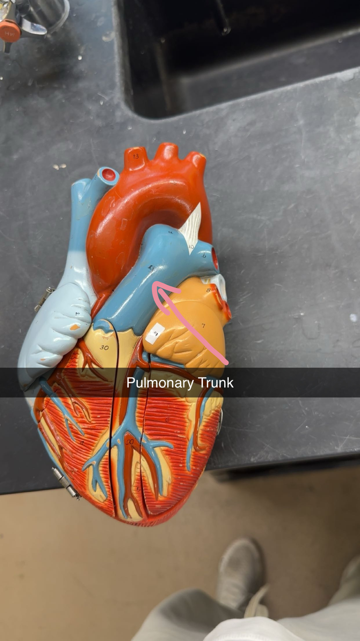 <p>Pulmonary Trunk</p>