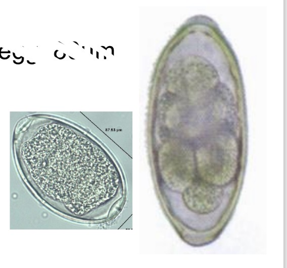 <p>Syngamus trachea life cycle - Egg morpholgy </p>