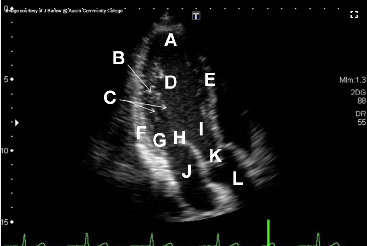 <p>Which structure is indicated by the Letter I on this image?</p>