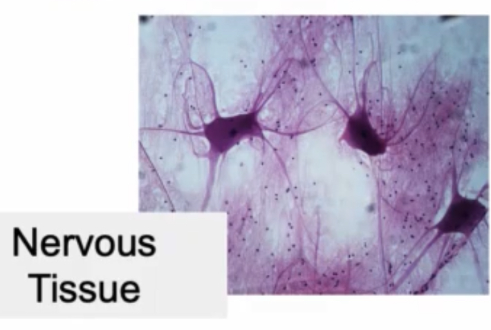 <p>Composed of neurons with a bunch of glia; bigger glial nuclei than other types; not a lot of nervous tissue compared to the big glial nuclei</p>
