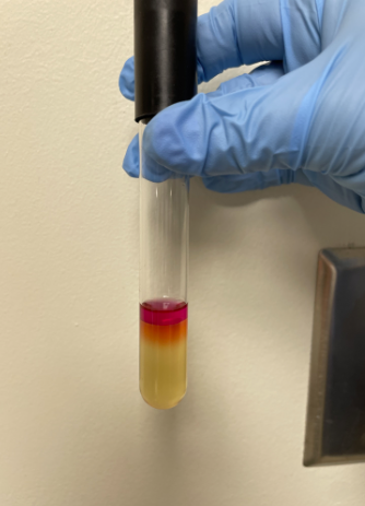 <p><span>Is the bacteria in the picture positive or negative for indole production?</span></p>