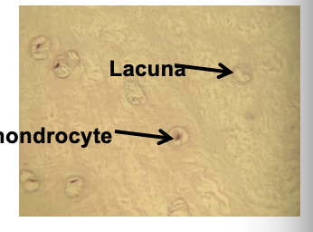 <p>intervertebral discs, pubic symphysis, tiny fibers</p>
