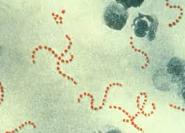 <p>Bacteria shape is in a chain</p><p></p>