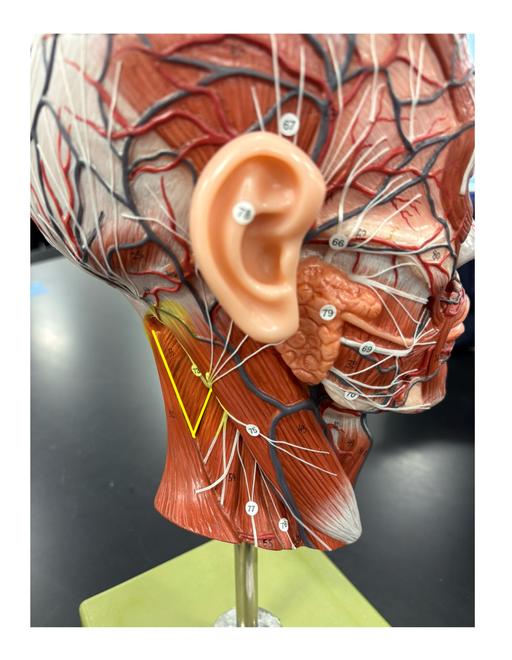 <p>name the muscle and its action</p>