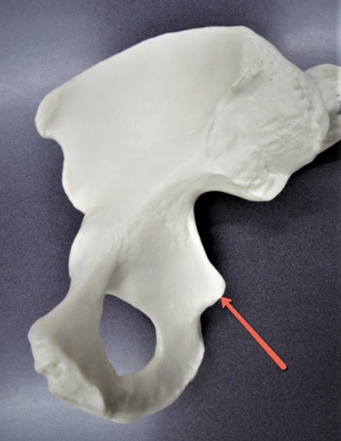 <p><strong>Identify the bone marking indicated by the pointer.</strong></p>