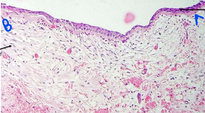 <p>A 12 year old with cyst of jaw</p>