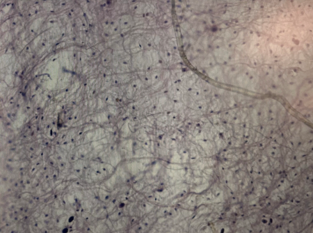 <p>what kind of tissue is this</p>