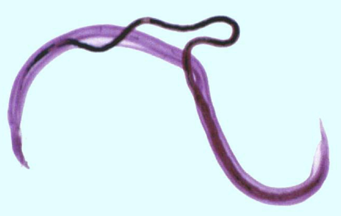 <p>What parasitic worm/fluke is this?</p>