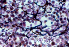 <p>Location: Thymus</p><p>Function: Forms stroma to support other cells</p>