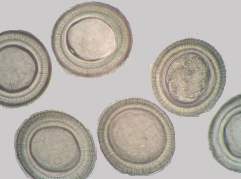 <p>What cestode/tapeworm/parasitic worm is this?</p>