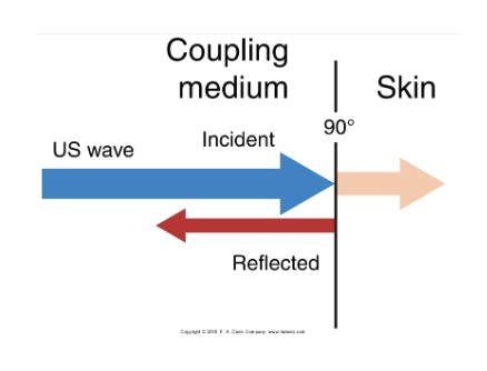 <p>a lot of US is reflected, and not absorbed into skin</p><p>coupling agent/medium helps to transmit the waves into skin rather than being reflected</p><ul><li><p>aqueous gel</p></li><li><p>underwater technique for wounds/irregular surfaces</p><ul><li><p>1 cm above skin</p></li></ul></li><li><p>gel bad</p></li></ul><p>don’t use creams or ointments </p><p></p>