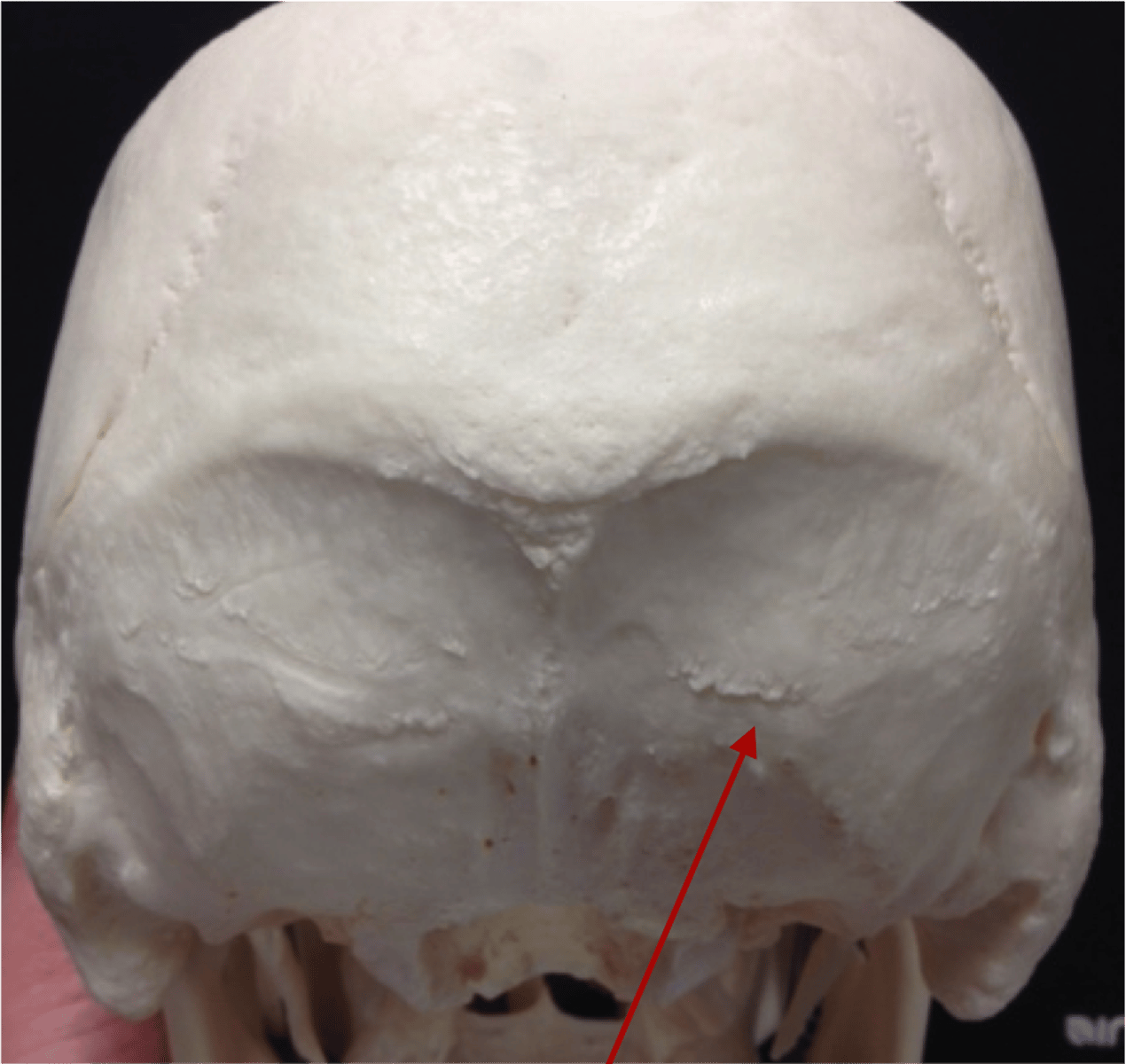 <p>What boney feature is this?</p>