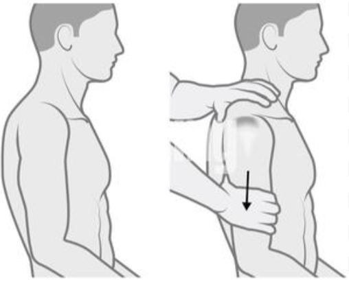 <p><strong>glenohumeral instability (shoulder subluxation/dislocation history)</strong></p><p><span style="background-color: transparent;">have patent sitting</span></p><p>grab shoulder with fingers on collarbone (to stabilize)</p><p>pull down on arm above elbow</p><p><span style="background-color: transparent;">positive if: sulcus in elbow (you can see shoulder dislocate)</span></p>