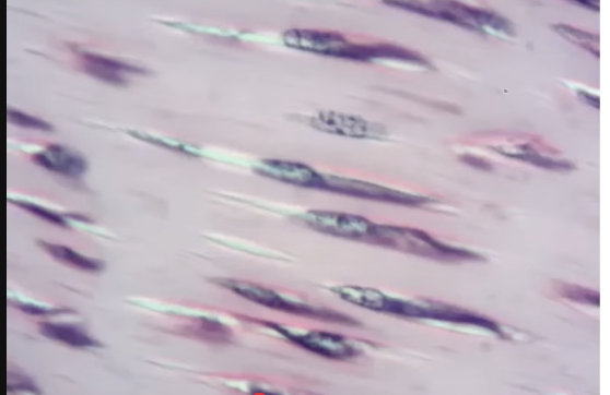 <p>fibers running in one direction in an image </p>