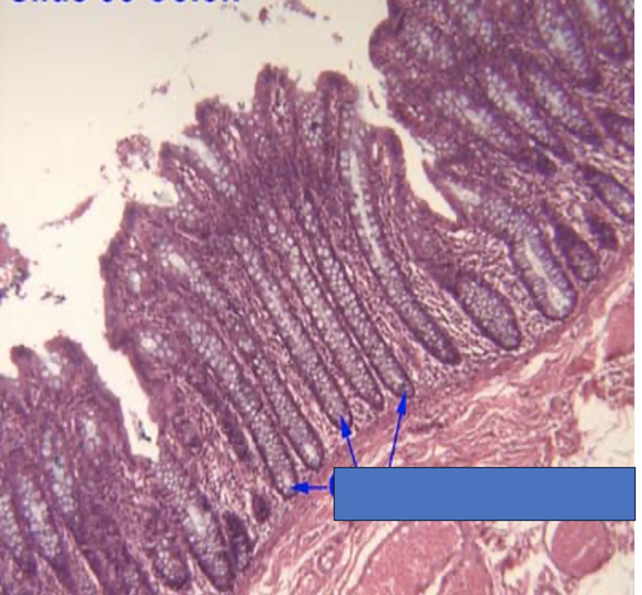 <p>Identify the structure</p>