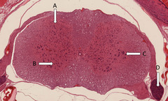 <p>In what region is the location of the preganglionic autonomic neuron cell bodies?</p>