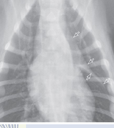 <p>arrow pointed the THYMUS</p>