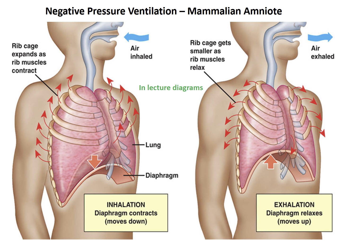 <p>Evolution of Negative-Pressure (suction) Lung Ventilation Derived Condition</p>