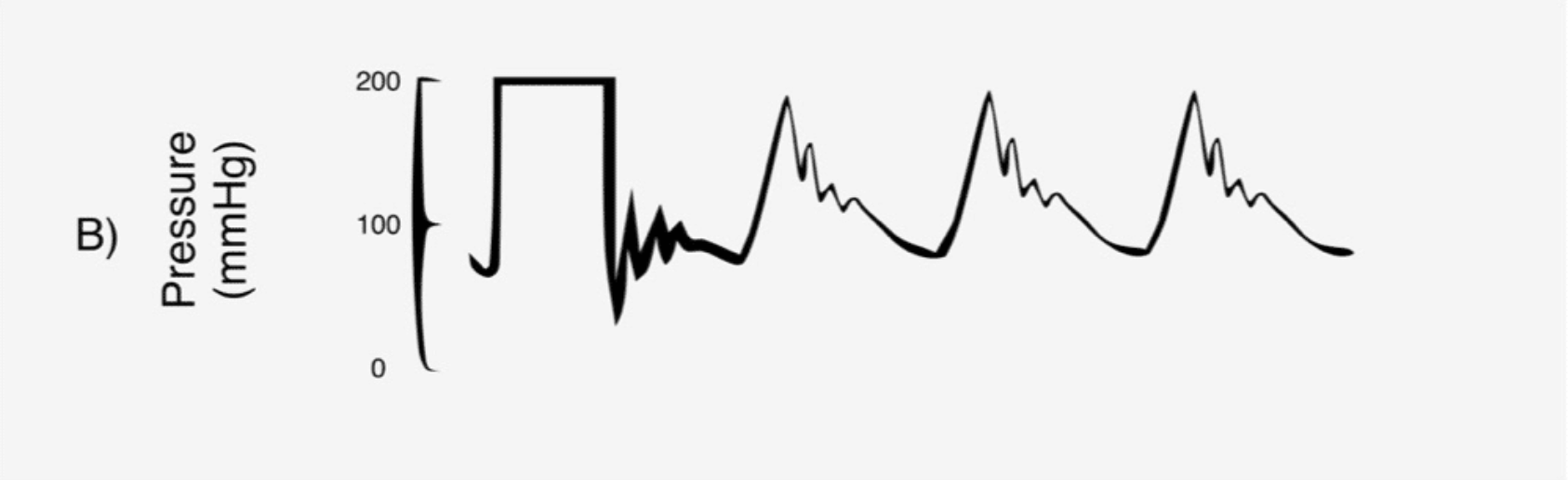 <p>what kind of damping</p>