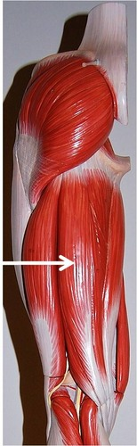 <p>What muscle is this?</p>