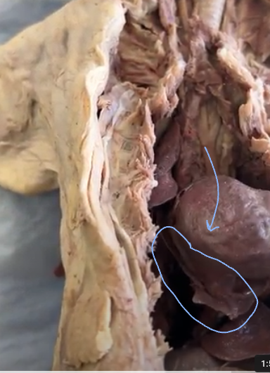 <p>Pericardium</p>
