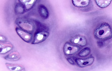 <p>Hyaline Cartilage Tissue</p>