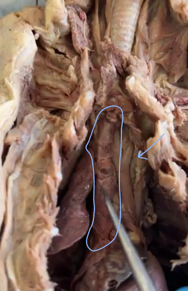 <p>superior vena cava</p>