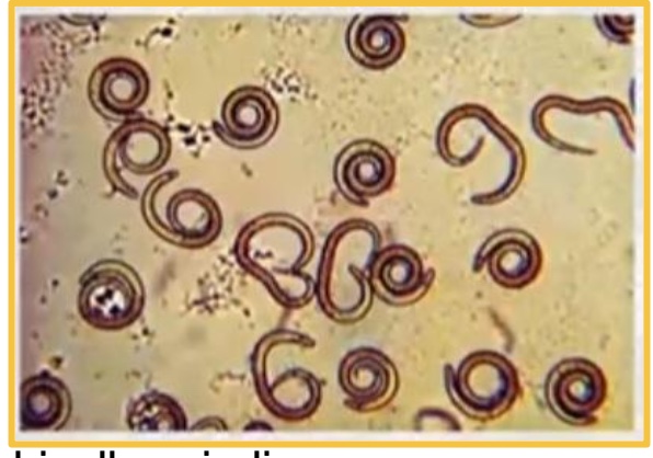<p>Trichinella spiralis </p>