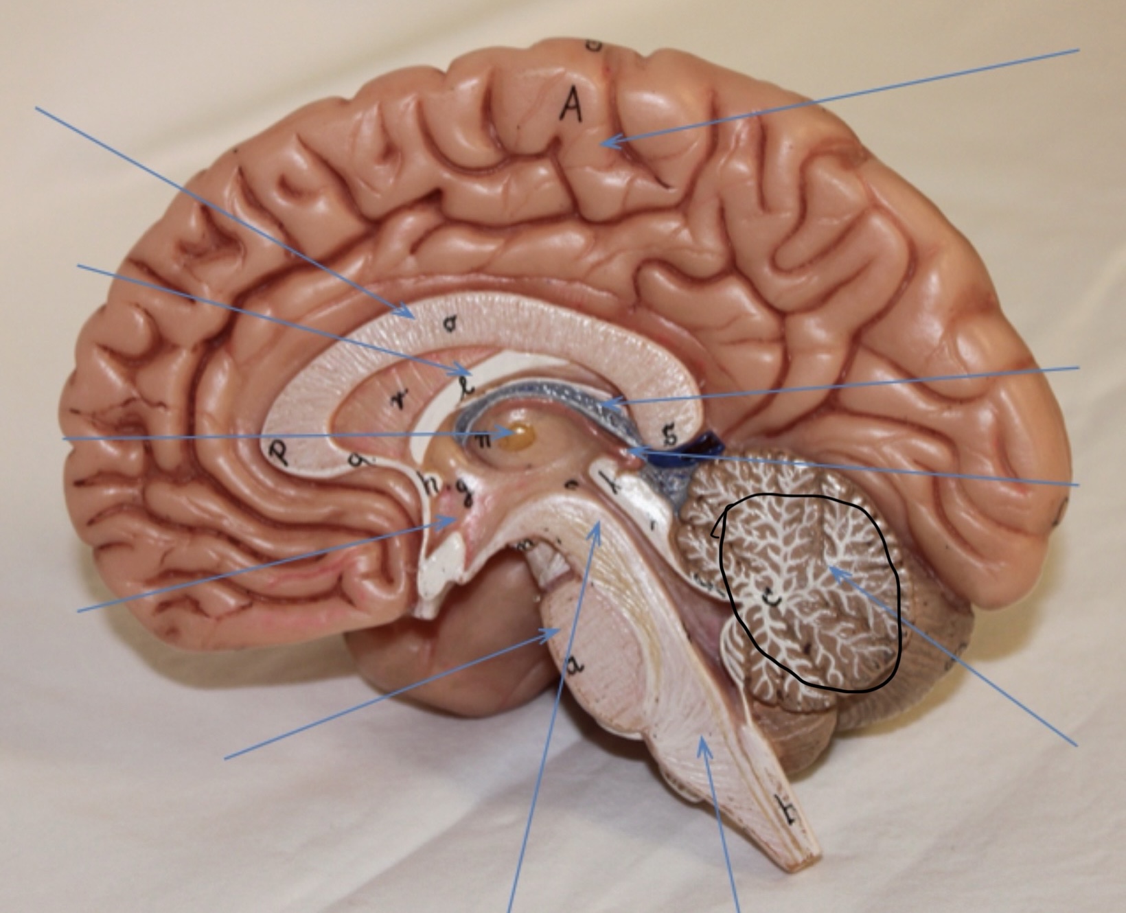 <p>Identify the circled area?</p>