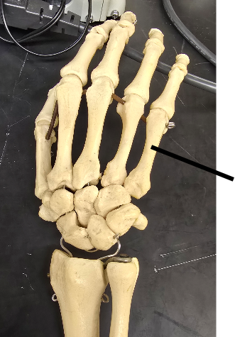 <p>Name Carpal Bone</p>