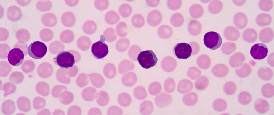<p>Identify the leukocyte and approximate WBC Differential Ranges</p>