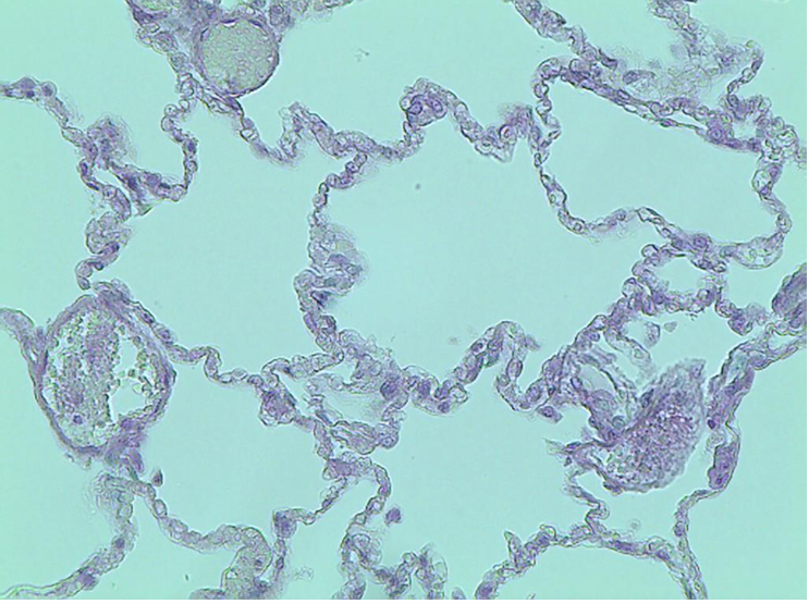 <p>what tissue is this?</p><p></p>