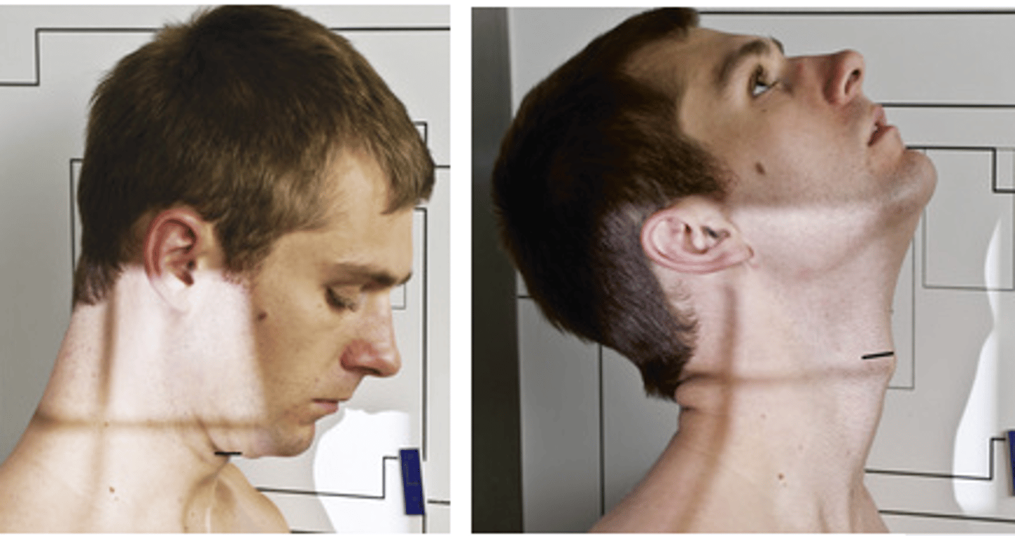<p>- What is the exam?</p><p>- What is the position?</p><p>- What is the SID?</p><p>- What is this view used for?</p><p>- What is the patient's position?</p><p>- What is done to the patient's head?</p><p>- What is opened when the head is hyperflexed?</p><p>- What is opened when the head is hyperextended?</p><p>- Where is the CR directed?</p><p>- What are the breathing instructions?</p>