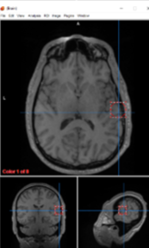 <p>lower somatosensory cortex</p>