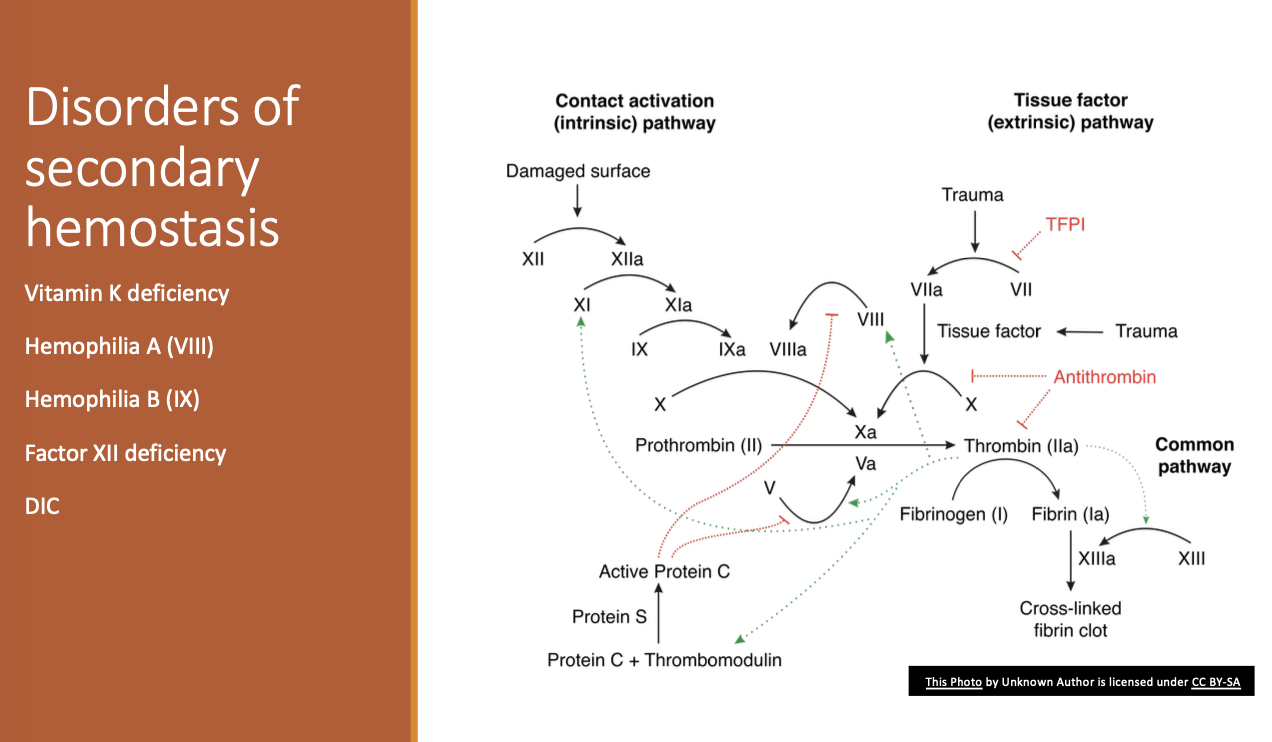 <p>Vit K deficiency.</p><p>Hemophilia A or B.</p><p>Factor 12 deficiency.</p><p>DIC.</p>