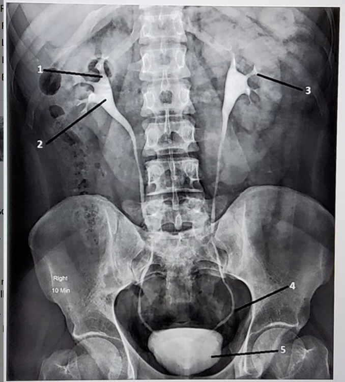 <p><span>Identify the anatomic structures labeled on this image. Your label should be descriptive (proximal/distal, which side of the body, etc)</span></p>