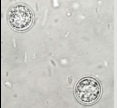 <p>genus, species, stage</p>