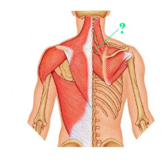 <p>Identify the indicated muscle</p>