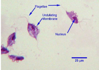 <p>Hx of decreased calving rate, fertility</p><p>vaginal, prepuce, or penis smear, sample, culture, or PCR </p>