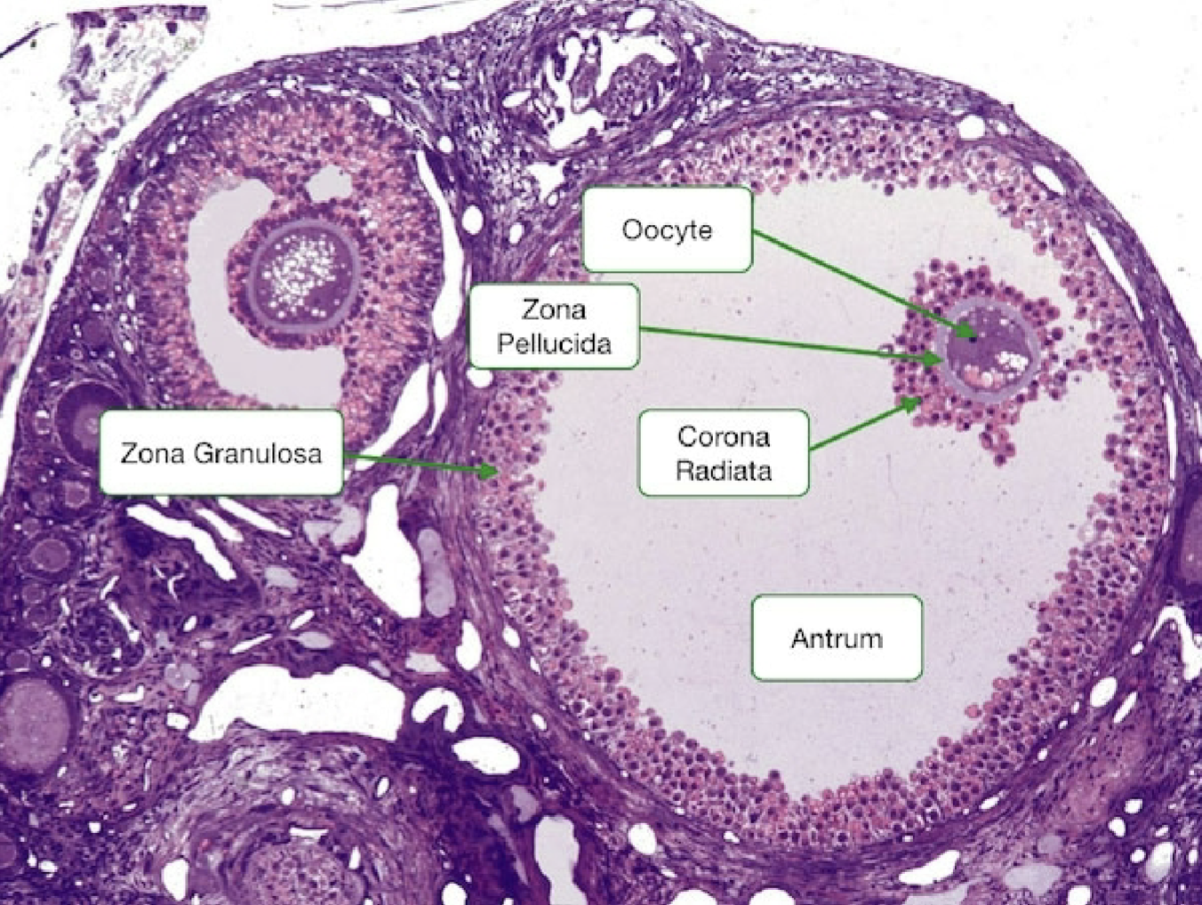 <p>Identify the stage of the follicle</p>