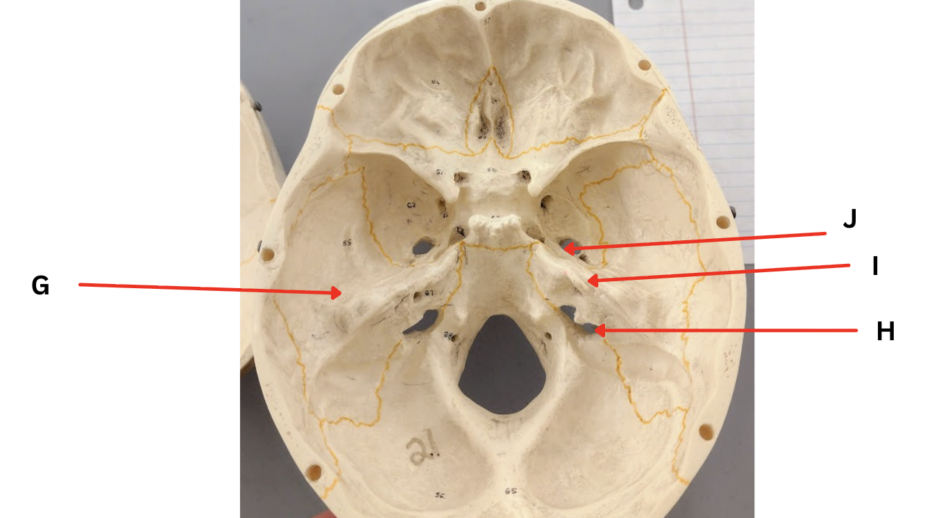 <p>Identify Marking H (large hole where petrous portion meets occipital portion)</p>