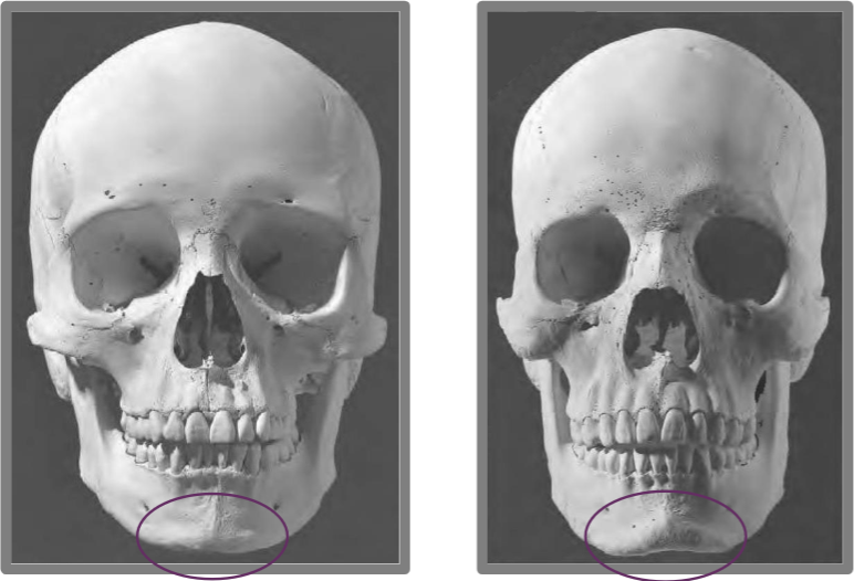 <p><span>Prominence at centre of mandible</span></p><p><span>Male → thicker, rugose<br>Female → smaller, gracile</span></p>