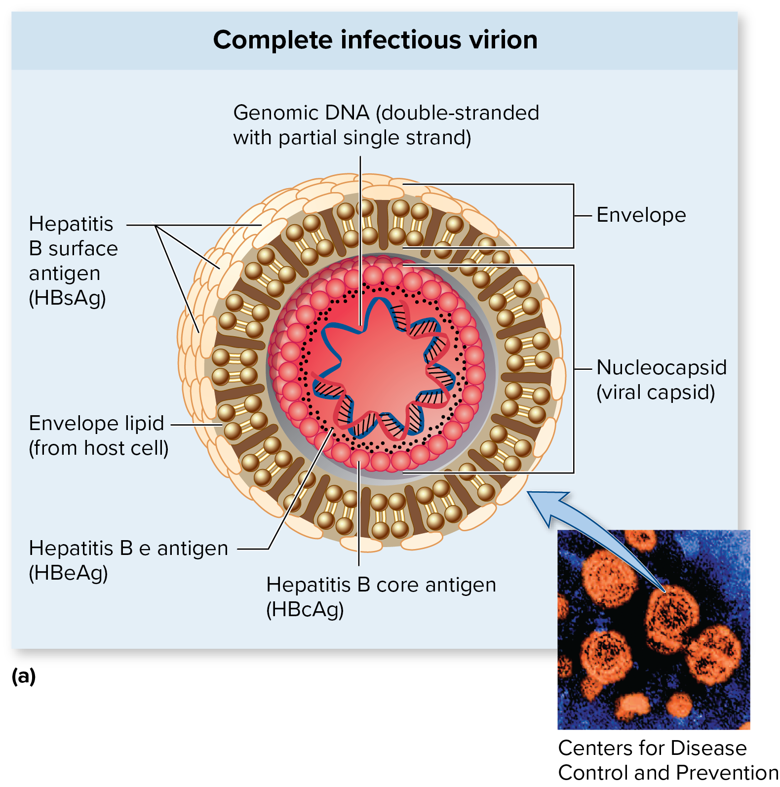 <p><strong>Hepatitis B</strong></p><p>Causative agent <strong><mark data-color="purple" style="background-color: purple; color: inherit;">[__]</mark></strong>: <mark data-color="yellow" style="background-color: yellow; color: inherit;">HBV</mark></p><p><mark data-color="yellow" style="background-color: yellow; color: inherit;">Enveloped, dsDNA (double-stranded DNA) genome, member of Hepadnaviridae family</mark></p>